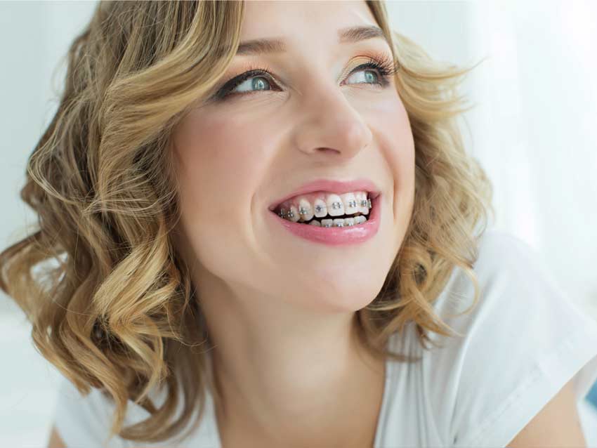 Ortodoncia en adultos