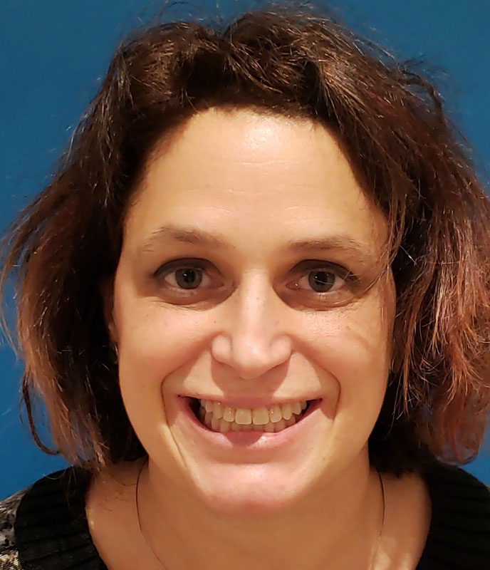 Caso Clínico de Marta. Foto frontal de su sonrisa después del tratamiento.