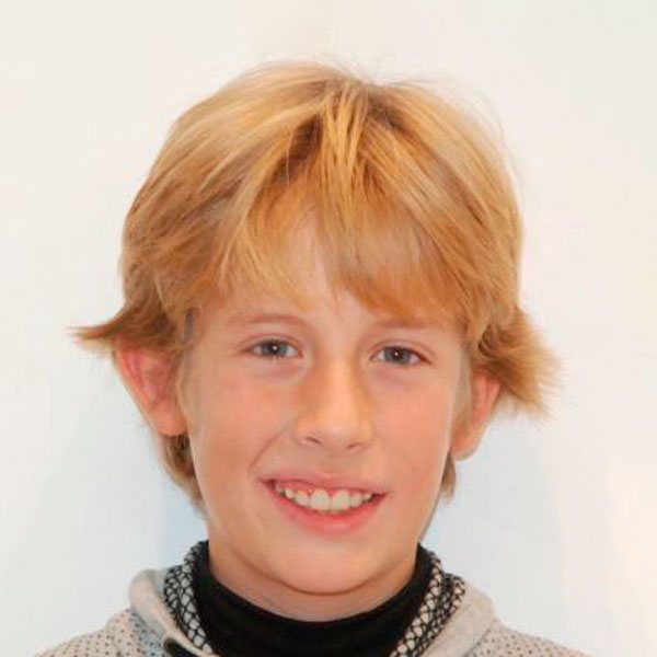Caso Clínico de Sergio. Foto de su sonrisa después del tratamiento.