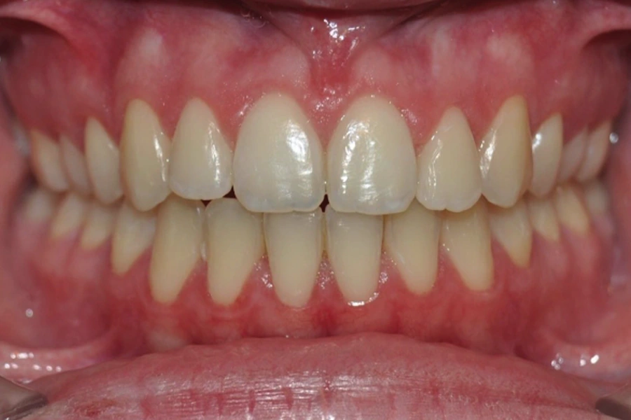 Carla García Orozco - Final fase 2 Carla García Orozco - Final fase 2