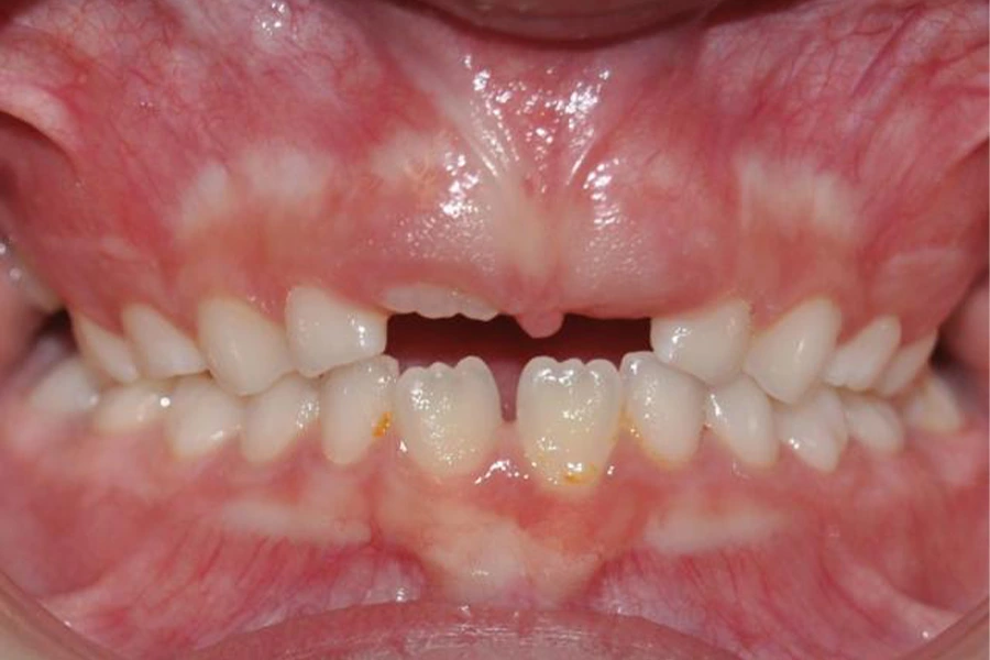 Carla García Orozco - Inicio fase 1 Carla García Orozco - Inicio fase 1