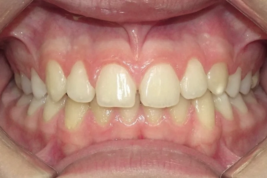 Caso clínico Manuel Climent - Inicio