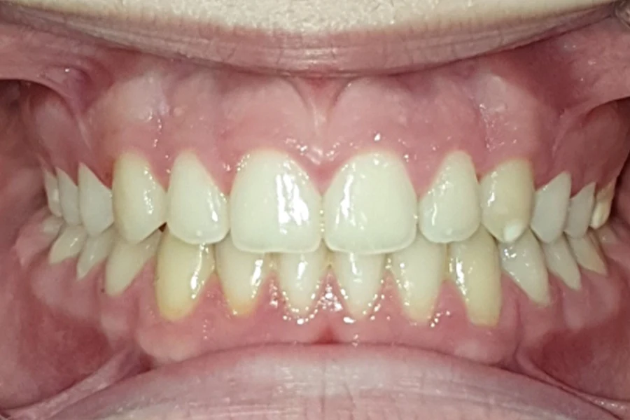 Caso clínico Manuel Climent - Final